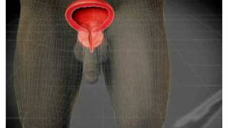 Plantas Curativas Cancer