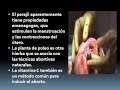 Plantas Curativas Caseras