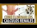 Plantas Curativas Para El Riñon